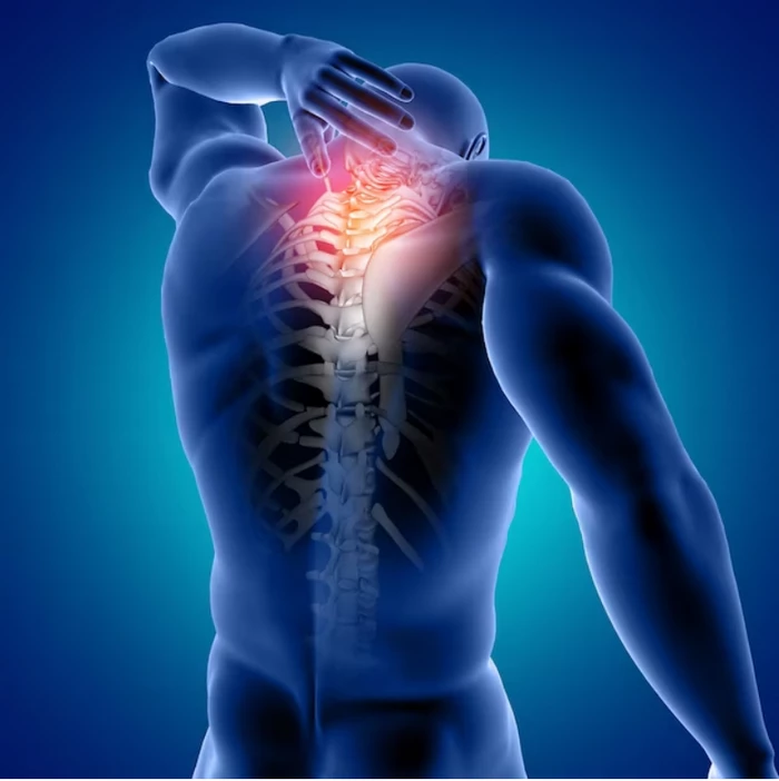 دیسک گردن چیست؛ خلاصی از دردهای ناشی از آن 5 علائم دیسک گردن چیست؟