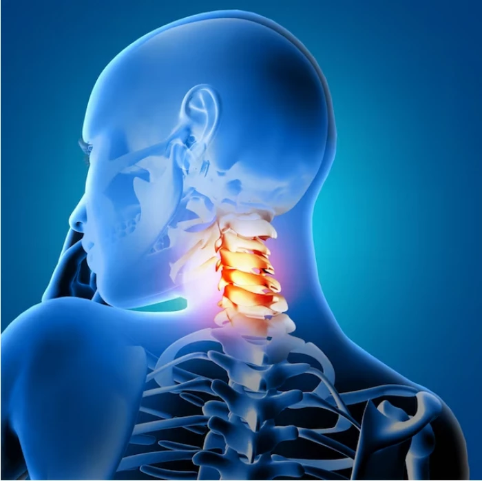 دیسک گردن چیست؛ خلاصی از دردهای ناشی از آن 9 خطرات جراحی دیسک گردن