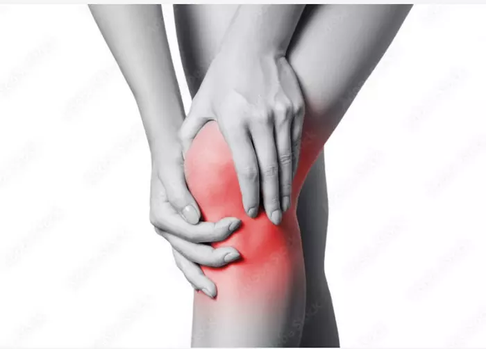 دلایل ایجاد زانوی ضربدری چیست؟ به چه علت ایجاد میشود؟ 4 زانوی ضربدری و محدودیت در فعالیت