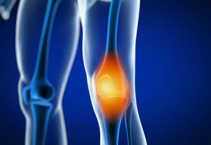 دلایل ایجاد زانوی ضربدری چیست؟ به چه علت ایجاد میشود؟ 5 علائم زانوی ضربدری چیست؟