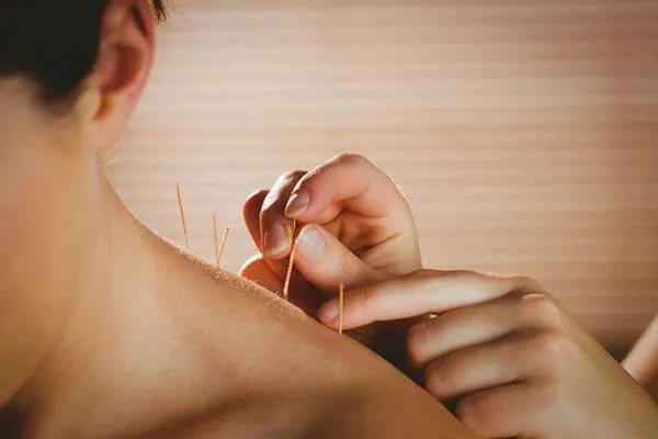 امبدینگ چیست؟ و چرا طرفداران زیادی به خود اتخصاص داده است؟ 3 کاشت نخ