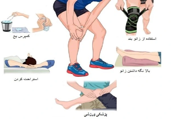 علتها ، راههای درمان و علائم نرمی کشکک زانو 9 نرمی غضروف کشکک زانو