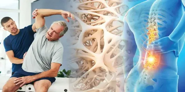 علتها، علائم، روشهای تشخیصی و درمانی پوکی استخوان 9 درمان پوکی استخوان
