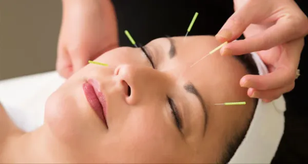 طب سوزنی 1 طب سوزنی چیست