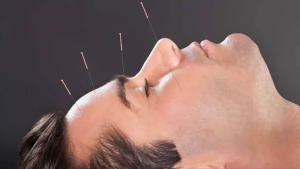 طب سوزنی 3 کاربرد طب سوزنی