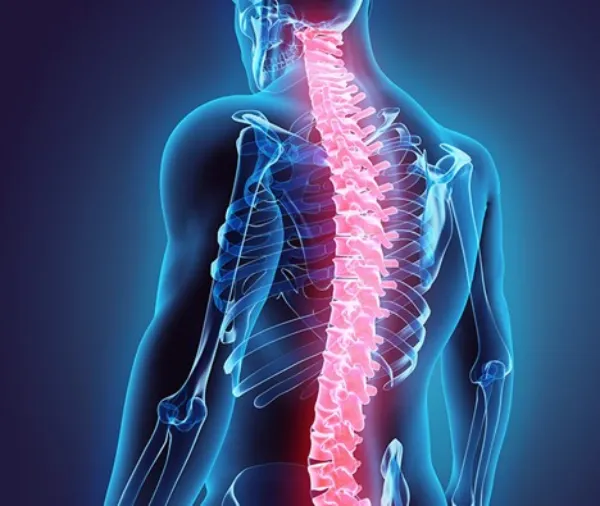 گرفتگی عضلات کمر 3 اسپاسم کمر