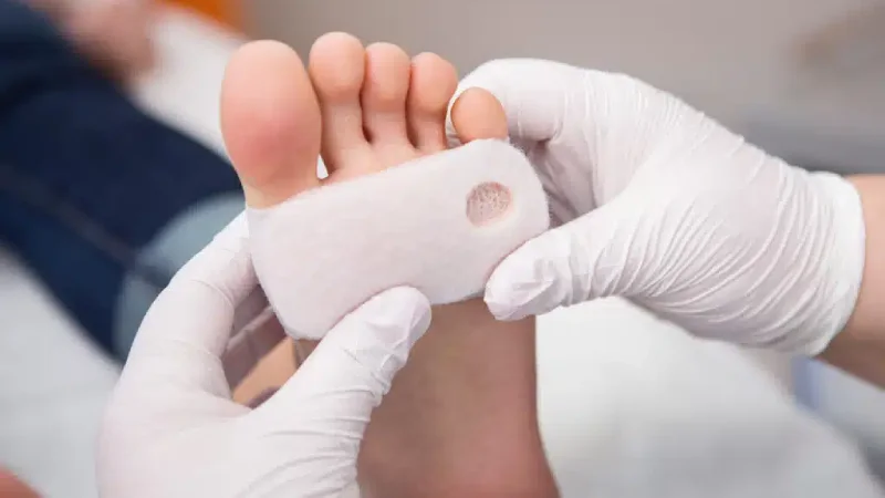 پای دیابتیک
