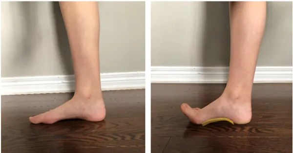 بهترین حرکات اصلاحی کف پای صاف؛ گامی به سوی سلامت پاها 3 ورزش برای درمان کف پای صاف