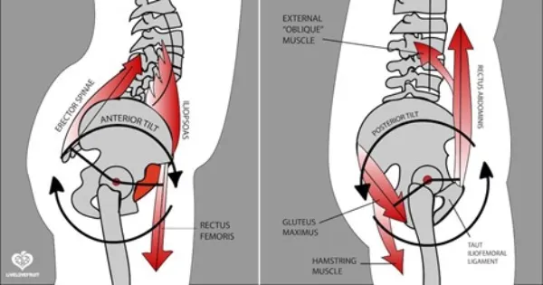 حرکات اصلاحی چرخش لگن