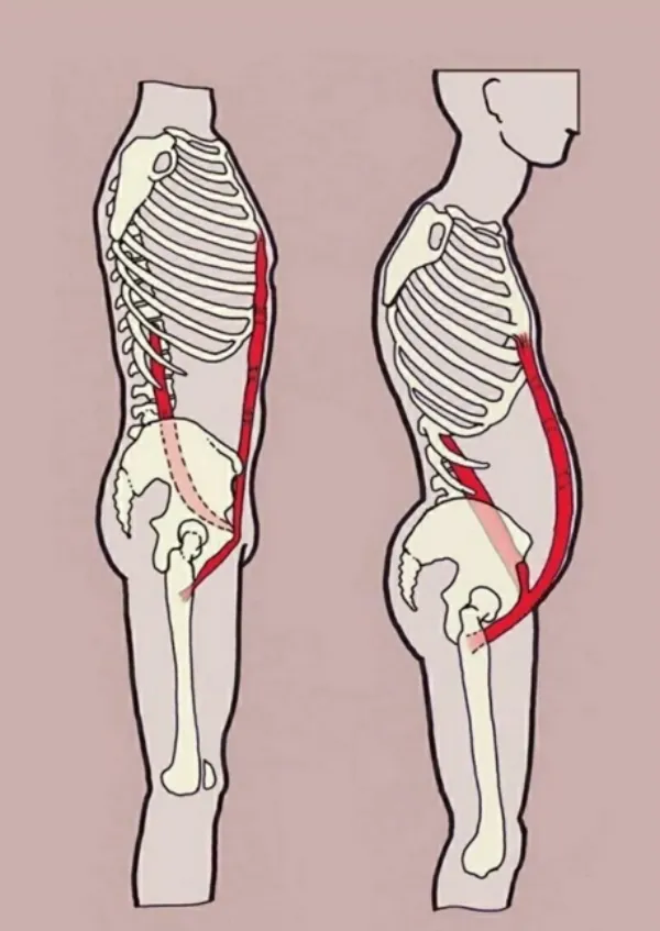 حرکات اصلاحی برای جابجایی لگن
