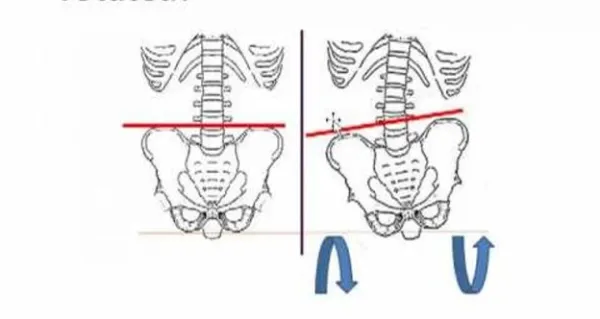 حرکات اصلاحی برای چرخش لگن