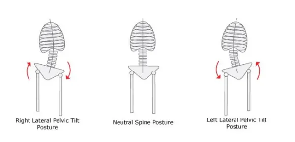 حرکات اصلاحی چرخش لگن