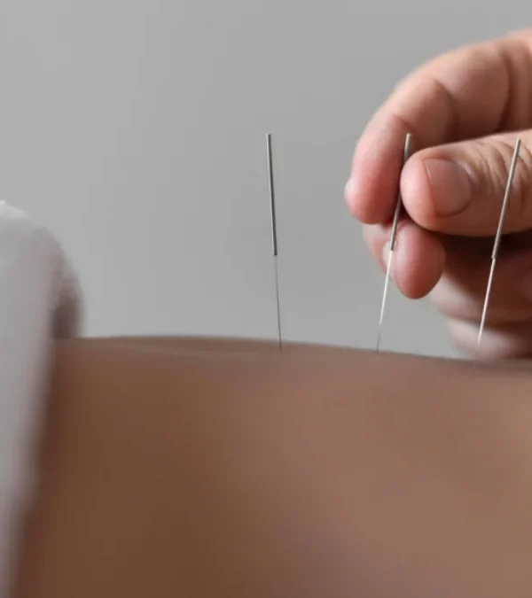 طب سوزنی برای تنبلی تخمدان