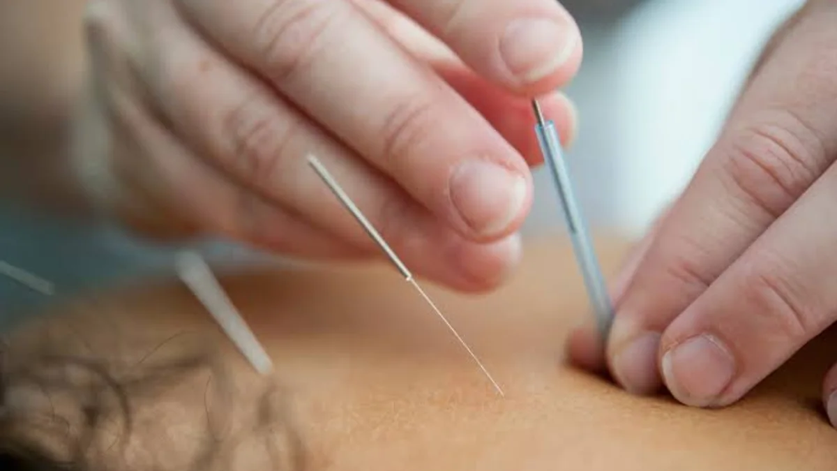 طب سوزنی یا امبدینگ؛ انتخابی مؤثر برای درمان و بهبود کیفیت زندگی 1 طب سوزنی یا امبدینگ