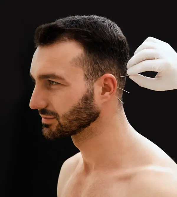 طب سوزنی یا امبدینگ؛ انتخابی مؤثر برای درمان و بهبود کیفیت زندگی 4 امبدینگ بهتره یا طب سوزنی