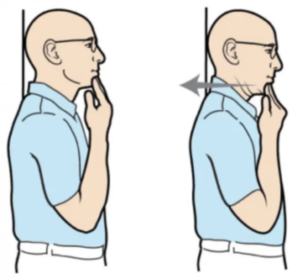 خداحافظی با قوز و درد گردن؛ معرفی حرکات اصلاحی گردن رو به جلو 3 حرکت اصلاحی گردن رو به جلو