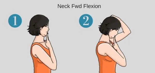 خداحافظی با قوز و درد گردن؛ معرفی حرکات اصلاحی گردن رو به جلو 4 حرکت اصلاحی سر و گردن به جلو