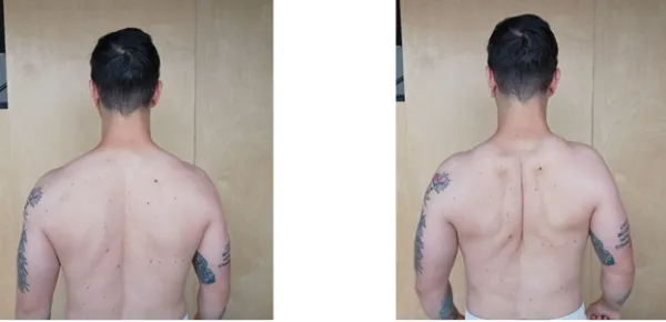 خداحافظی با قوز و درد گردن؛ معرفی حرکات اصلاحی گردن رو به جلو 8 حرکت اصلاحی گردن رو به جلو