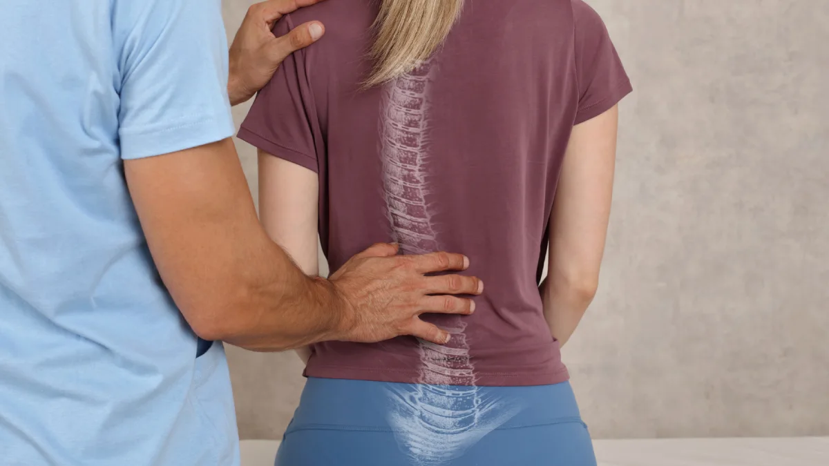 حرکات اصلاحی اسکولیوز