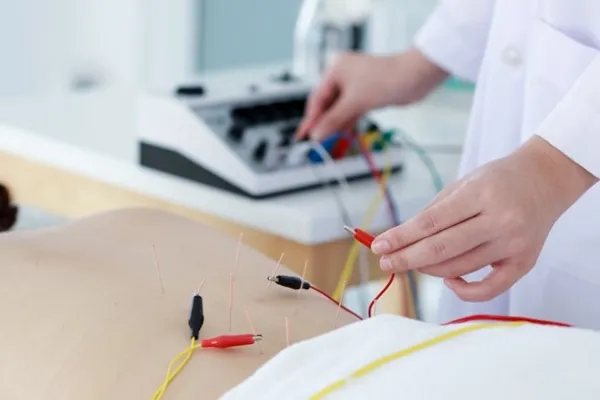 طب سوزنی برای دیسک کمر؛ چرا یک متخصص حاذق، کلید موفقیت درمان مشکل شماست؟ 4 فواید طب سوزنی برای دیسک کمر