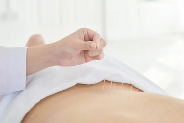 طب سوزنی برای سیاتیک