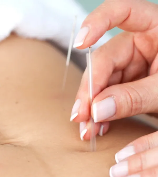 طب سوزنی برای لاغری