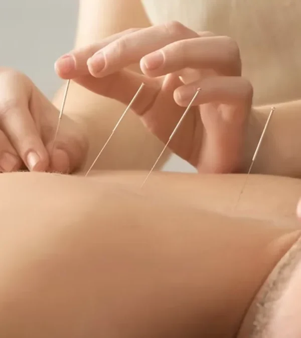 طب سوزنی و گرفتگی عضلات