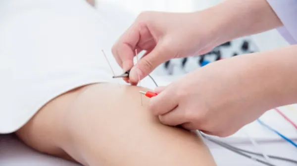 آیا طب سوزنی الکتریکی واقعا موثر است؟ نگاهی به تحقیقات جدید 7 طب سوزنی الکتریکی چیست