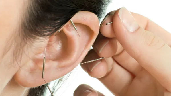 درمان وزوز گوش با طب سوزنی