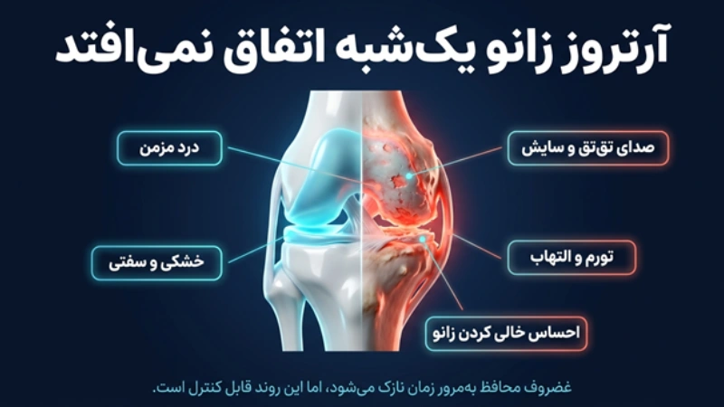 درمان ارتروز زانو