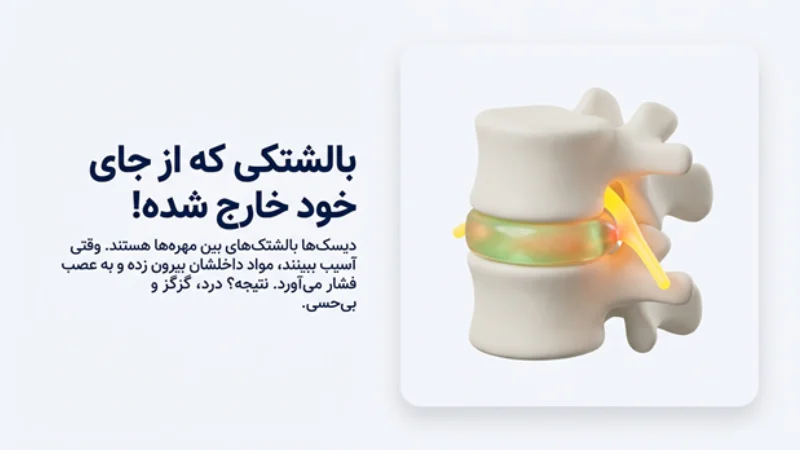 درمان بدون جراحی دیسک کمر و گردن